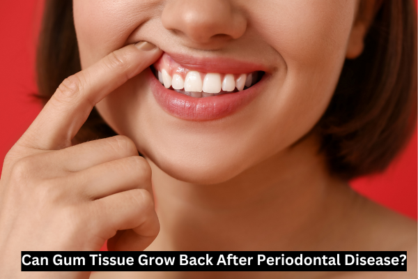 You are currently viewing Can Gum Tissue Grow Back After Periodontal Disease?