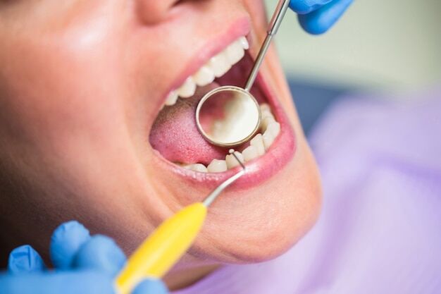 Read more about the article Transform Smile with Composite Bonding: Guide to a Flawless Dental Makeover