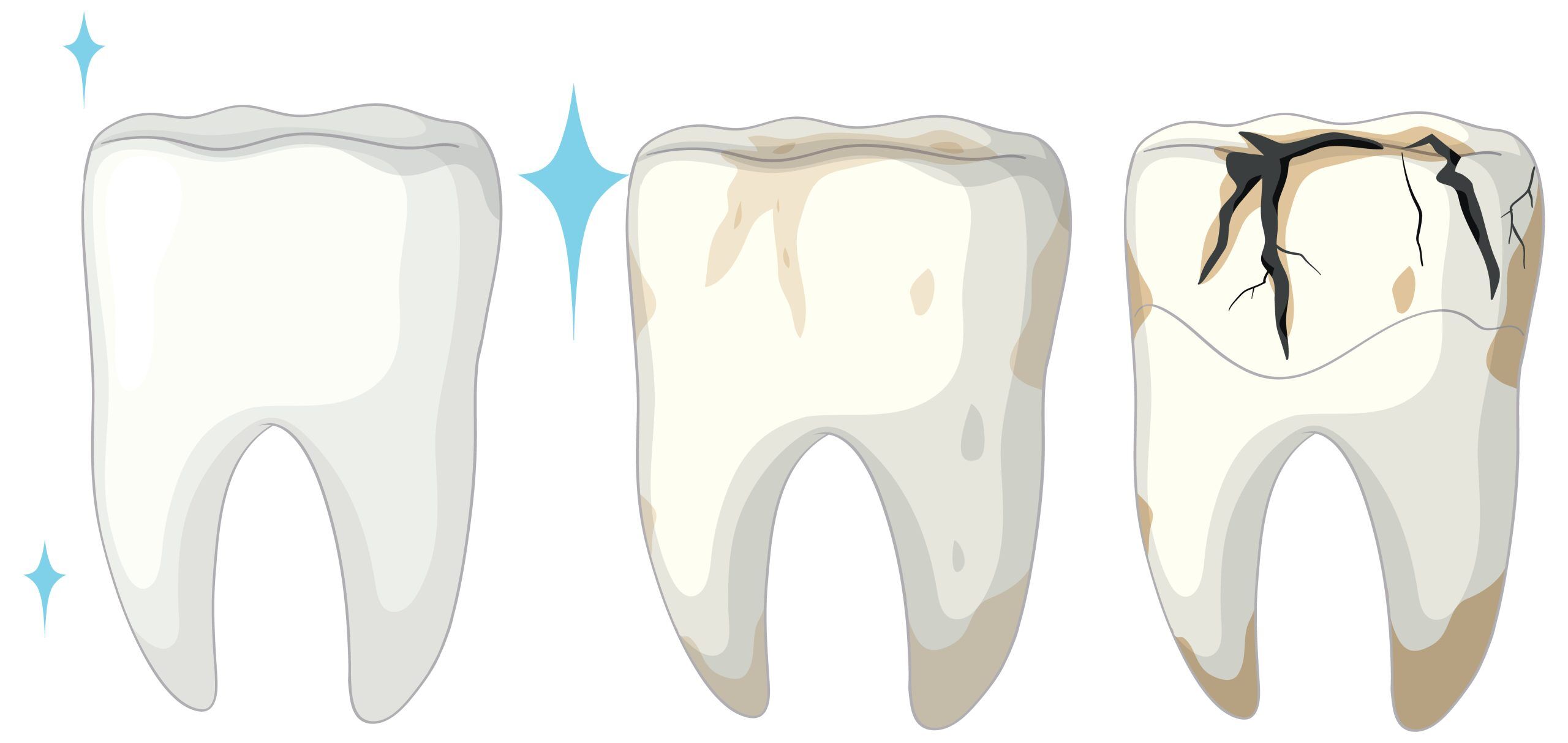 Read more about the article What to Expect Before and After Your Root Canal?
